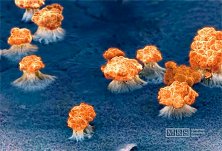 Illustration for article titled Exploding Nano-Wires Create Maybe the Coolest Picture We've Ever Seen